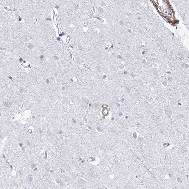 Staining of human cerebral cortex shows no positivity in neurons as expected.