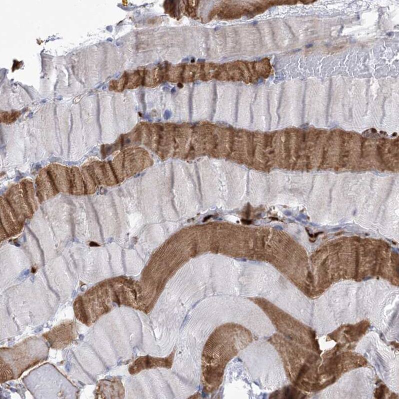 Staining of human skeletal muscle shows strong cytoplasmic positivity in myocytes.