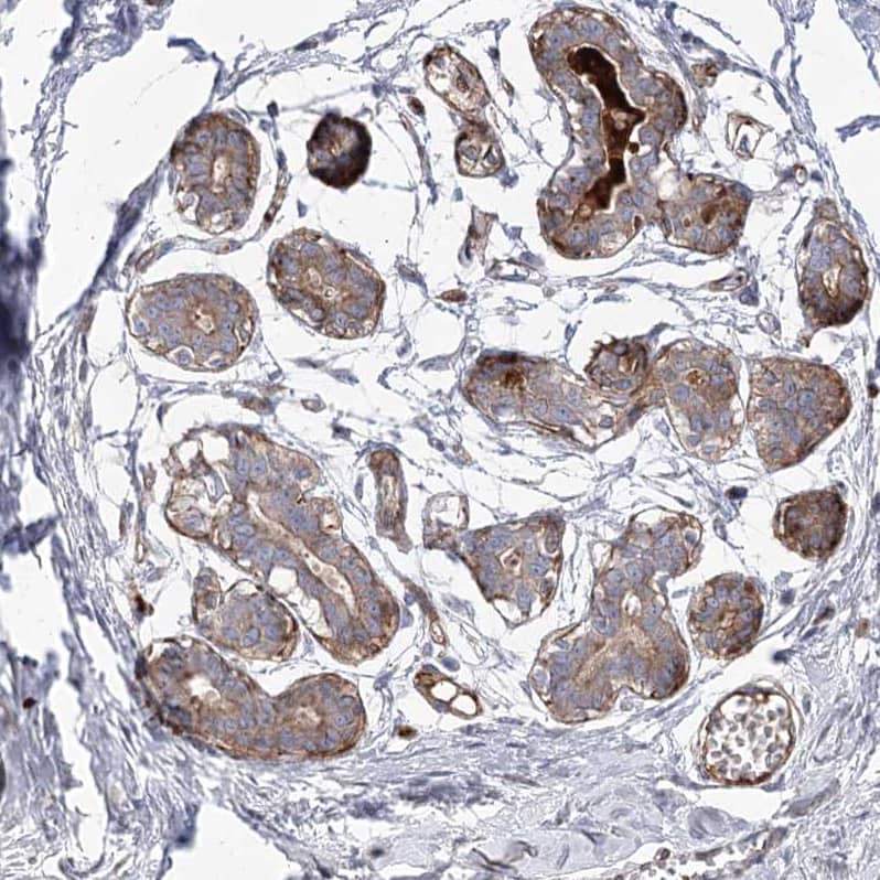 Staining of human breast shows no cytoplasmic positivity in myoepithelial cells.
