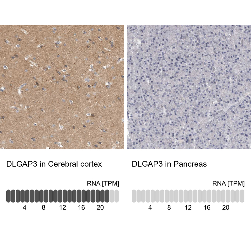 Analysis in human cerebral cortex and pancreas tissues using Anti-DLGAP3 antibody. Corresponding DLGAP3 RNA-seq data are presented for the same tissues.