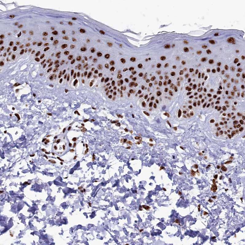 Immunohistochemistry-Paraffin SRRM2 Antibody - BSA Free