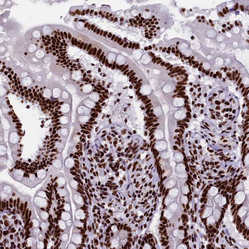 Immunohistochemistry-Paraffin SRRM2 Antibody - BSA Free