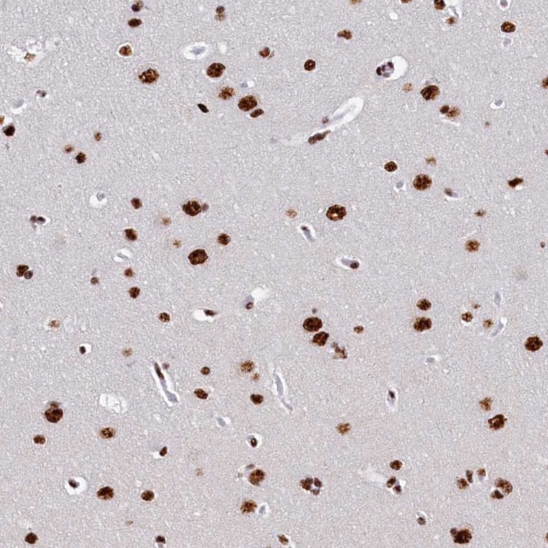 Staining of human cerebral cortex shows strong nuclear positivity in neuronal cells.