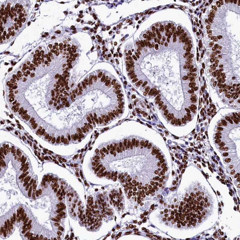 Staining of human endometrium shows strong nuclear positivity in glandular cells.