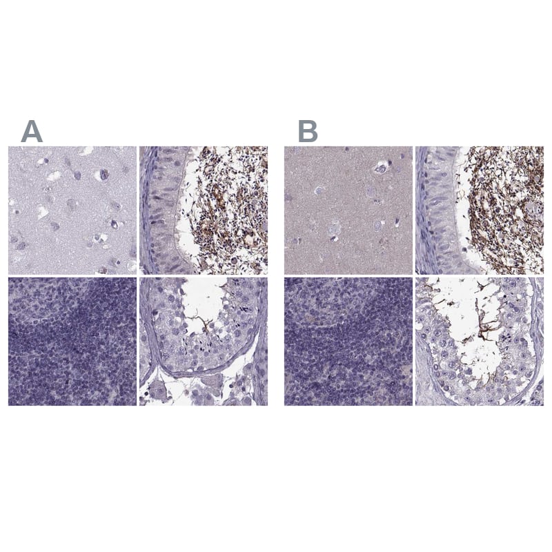 <b>Orthogonal Strategies Validation. </b>Staining of human cerebral cortex, epididymis, lymph node and testis HPA039241 (A) shows similar protein distribution across tissues to independent antibody HPA038919 (B).