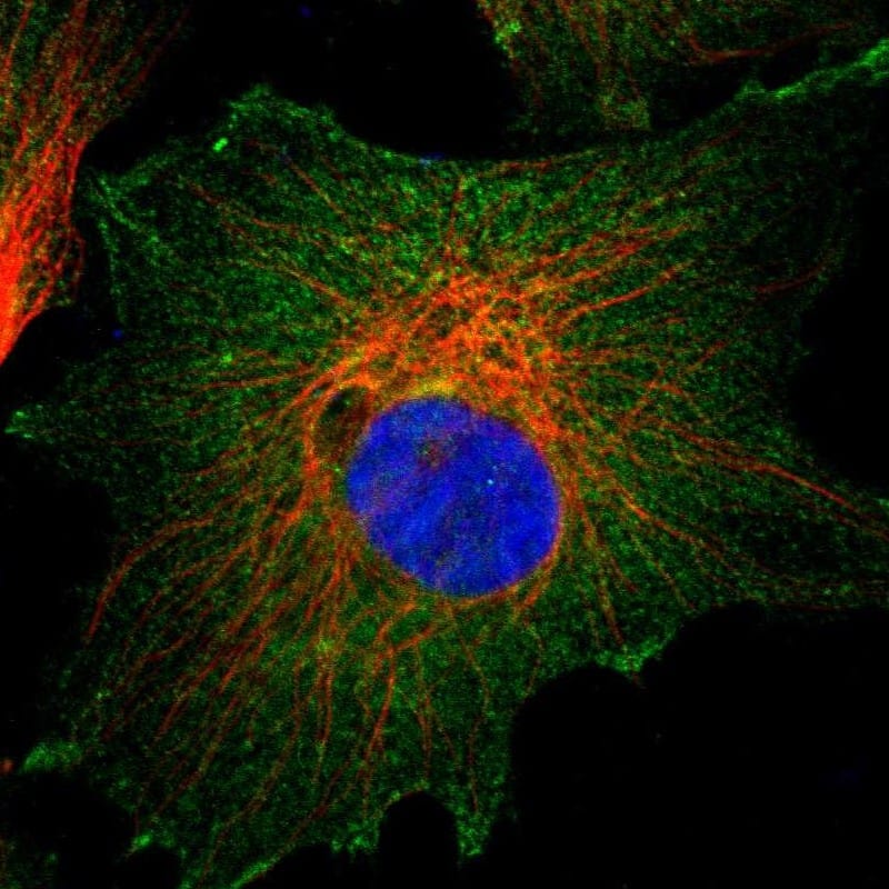 Staining of human cell line U-251 MG shows localization to plasma membrane & cytosol.