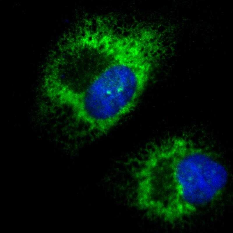 Staining of human cell line U-251 MG shows localization to endoplasmic reticulum.
