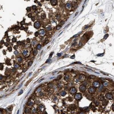 Immunohistochemistry kinectin Antibody - BSA Free