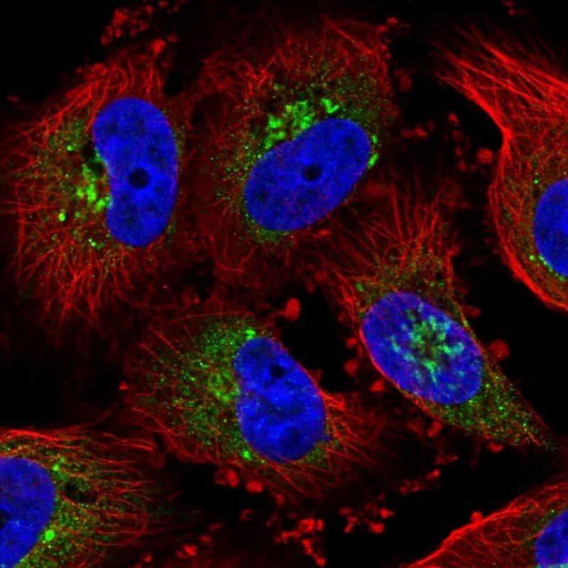 Staining of human cell line U-251 MG shows localization to the Golgi apparatus.