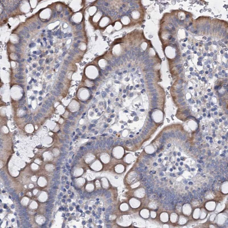 Staining of human small intestine shows moderate cytoplasmic positivity in glandular cells.