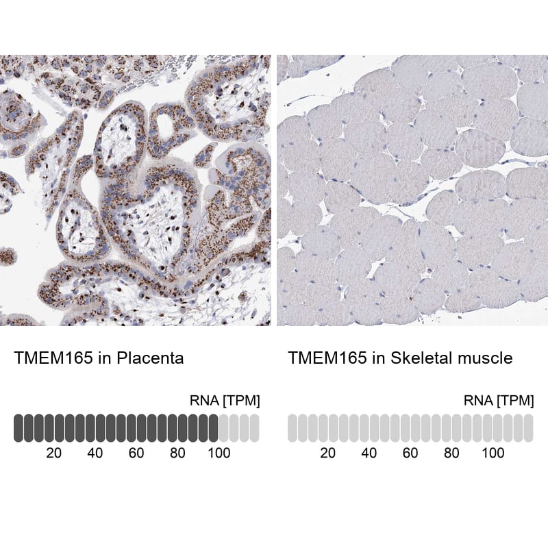 Immunohistochemistry-Paraffin TMEM165 Antibody - BSA Free