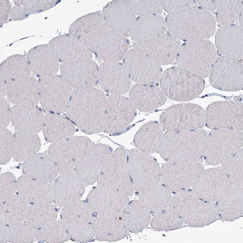 Immunohistochemistry-Paraffin TMEM165 Antibody - BSA Free