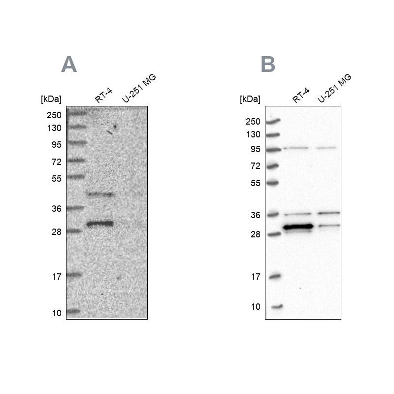 Western Blot PPTC7 Antibody - BSA Free