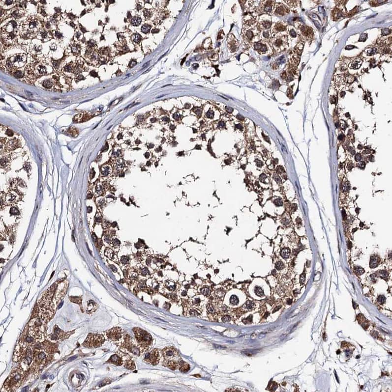 Staining of human testis shows strong granular cytoplasmic positivity in Leydig cells and cells in seminiferous ducts.