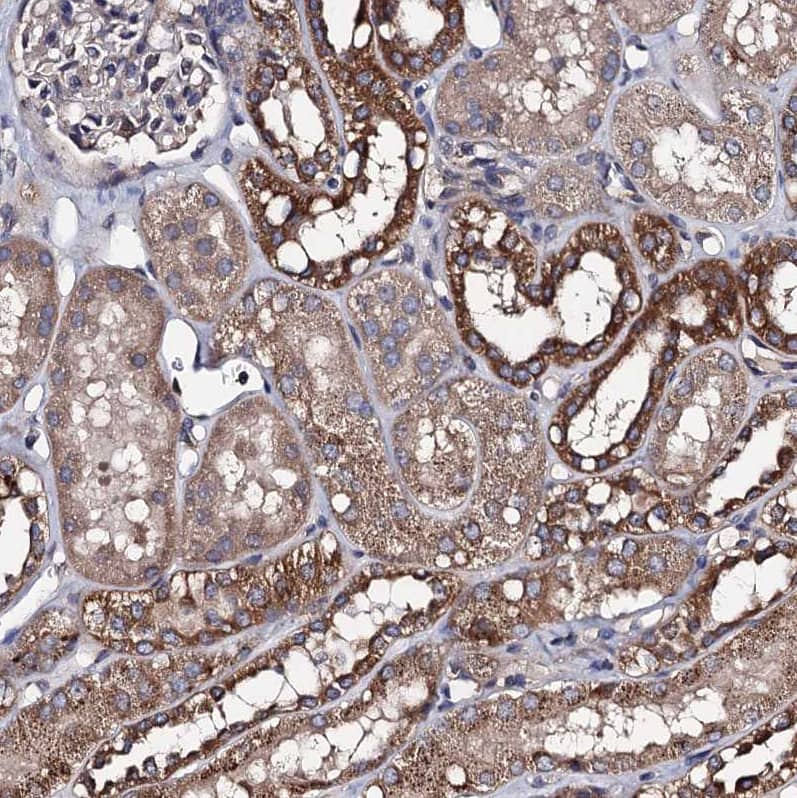Staining of human kidney shows strong granular cytoplasmic positivity in cells in tubules.