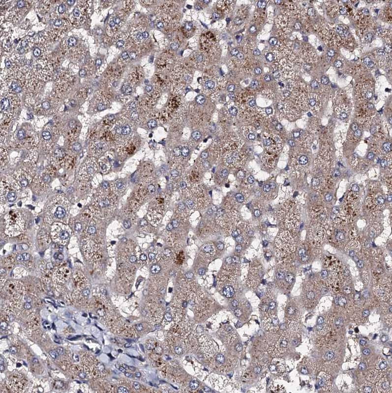 Staining of human liver shows moderate granular cytoplasmic positivity in hepatocytes.
