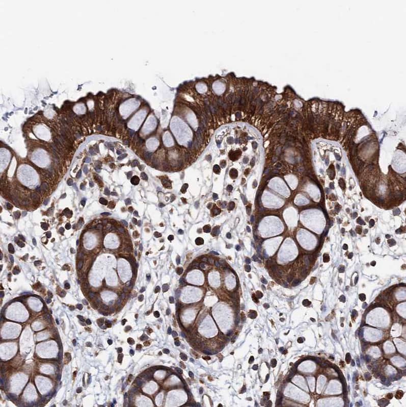 Staining of human rectum shows strong granular cytoplasmic positivity in glandular cells.