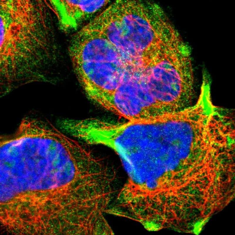 Staining of human cell line A-431 shows positivity in nucleoli & cytoplasm.