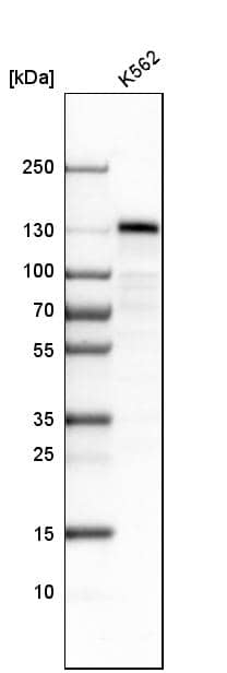 Analysis in human cell line K562.