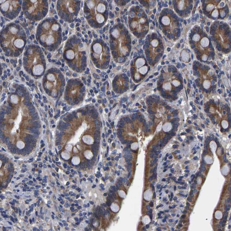 Staining of human duodenum shows moderate cytoplasmic positivity in glandular cells.