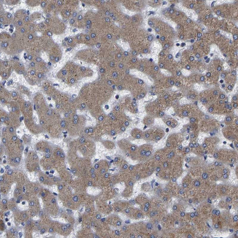 Staining of human liver shows moderate cytoplasmic positivity in hepatocytes.
