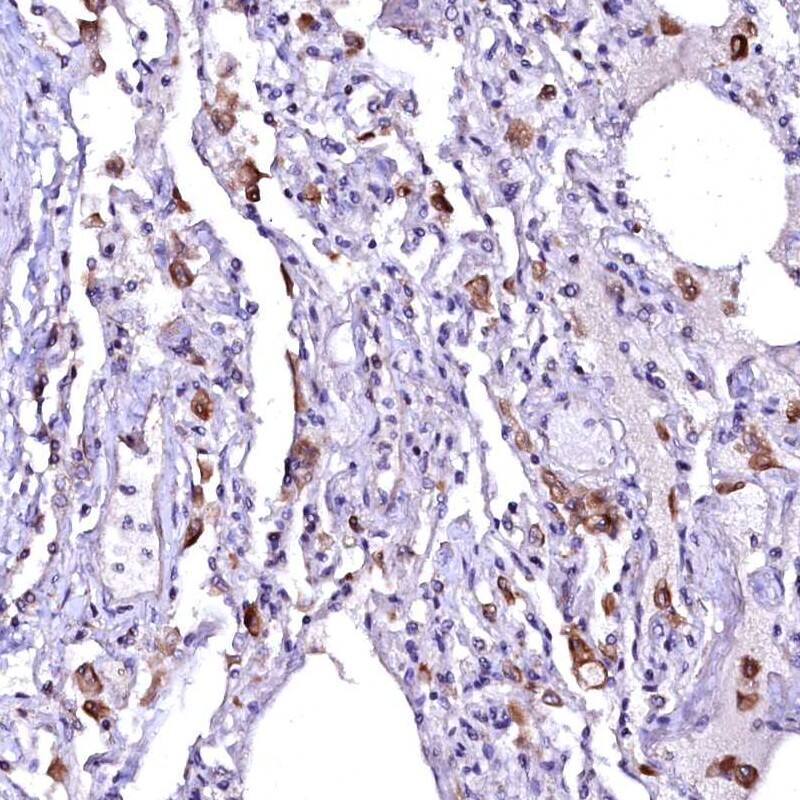 Staining of human lung shows strong cytoplasmic positivity in macrophages.
