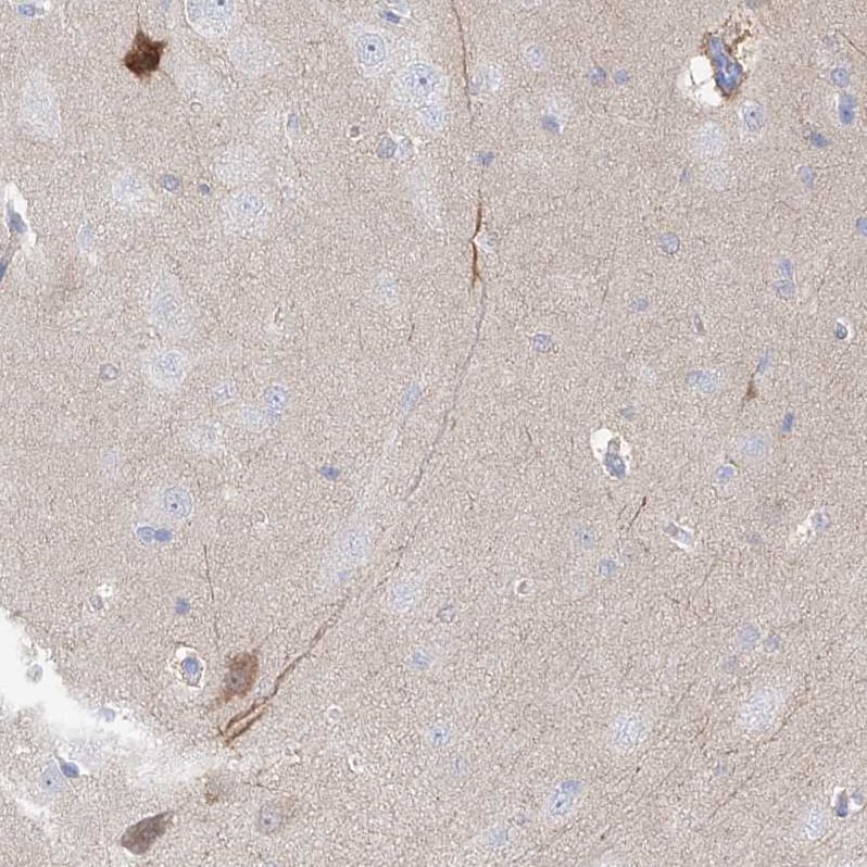 Staining of human cerebral cortex shows moderate positivity in neuronal processes in neuropil and a subset of neuronal cells.