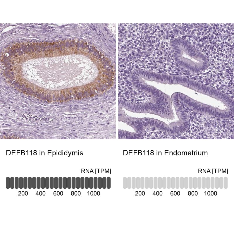 Analysis in human epididymis and endometrium tissues using Anti-DEFB118 antibody. Corresponding DEFB118 RNA-seq data are presented for the same tissues.