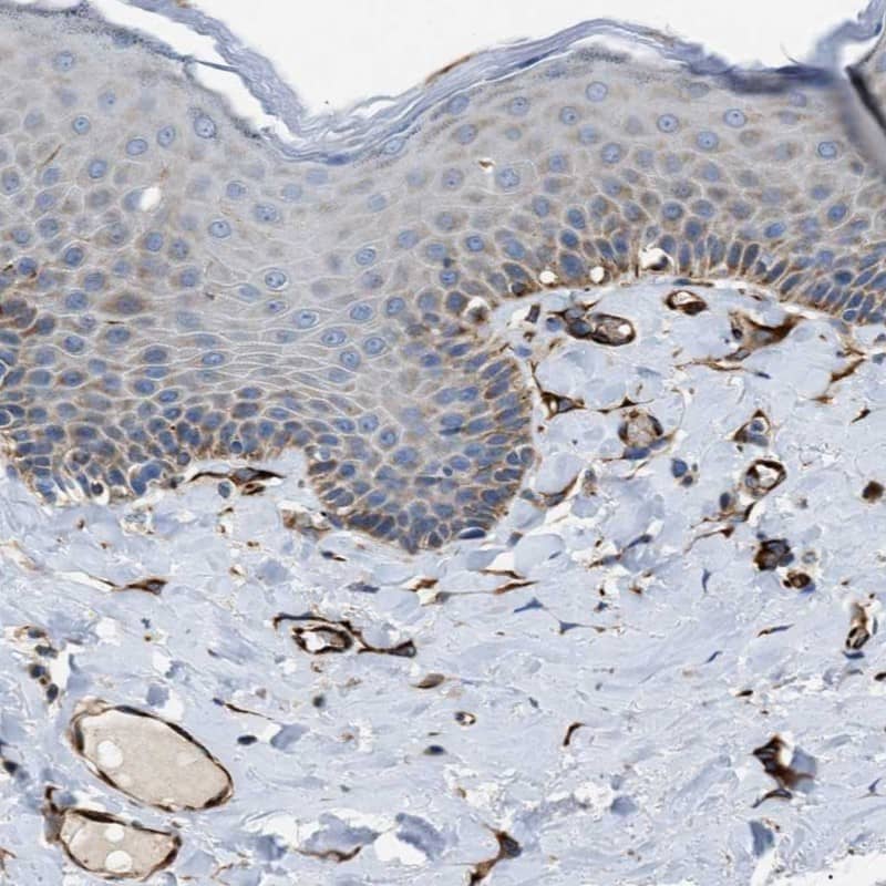 Staining of human vulva/anal skin shows distinct positivity in blood vessels.