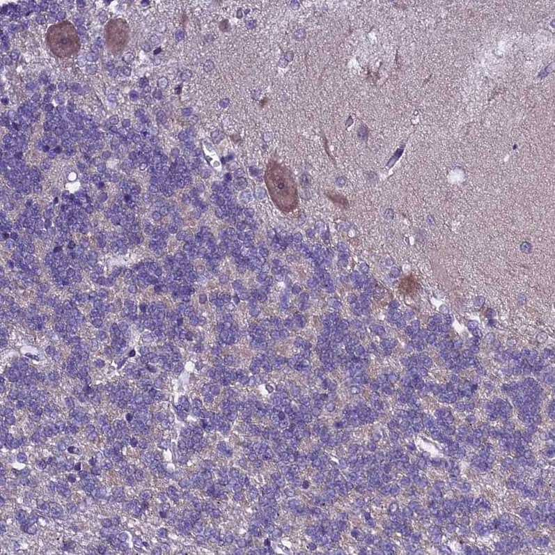 Staining of human cerebellum shows moderate cytoplasmic positivity in Purkinje cells.