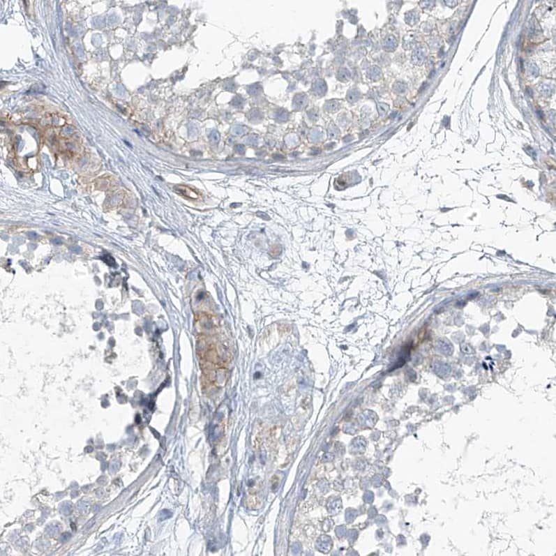 Immunohistochemistry-Paraffin TENC1 Antibody - BSA Free