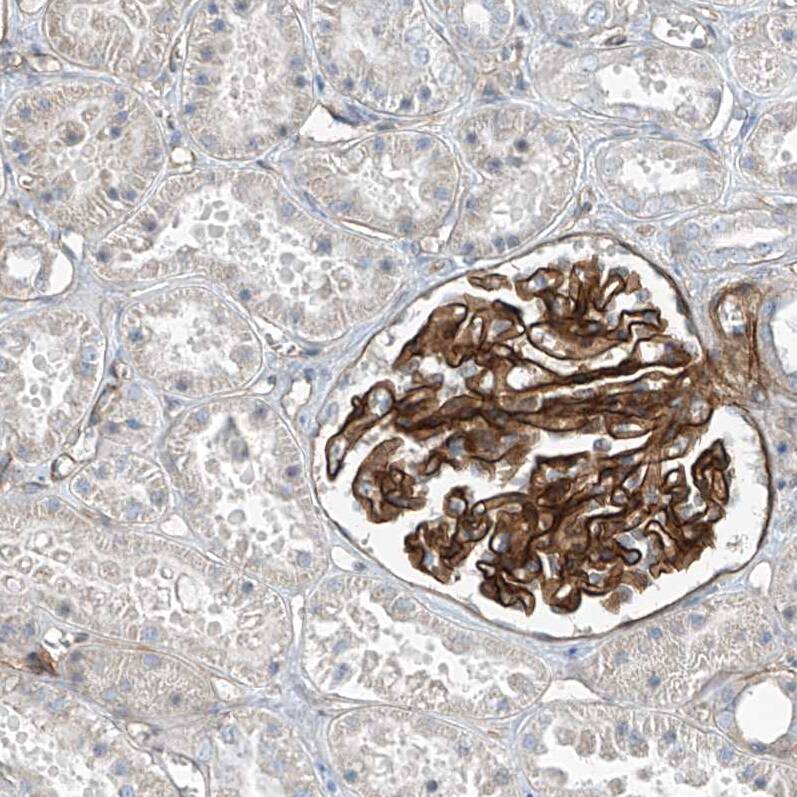 Staining of human kidney shows strong membranous positivity in cells in glomeruli.