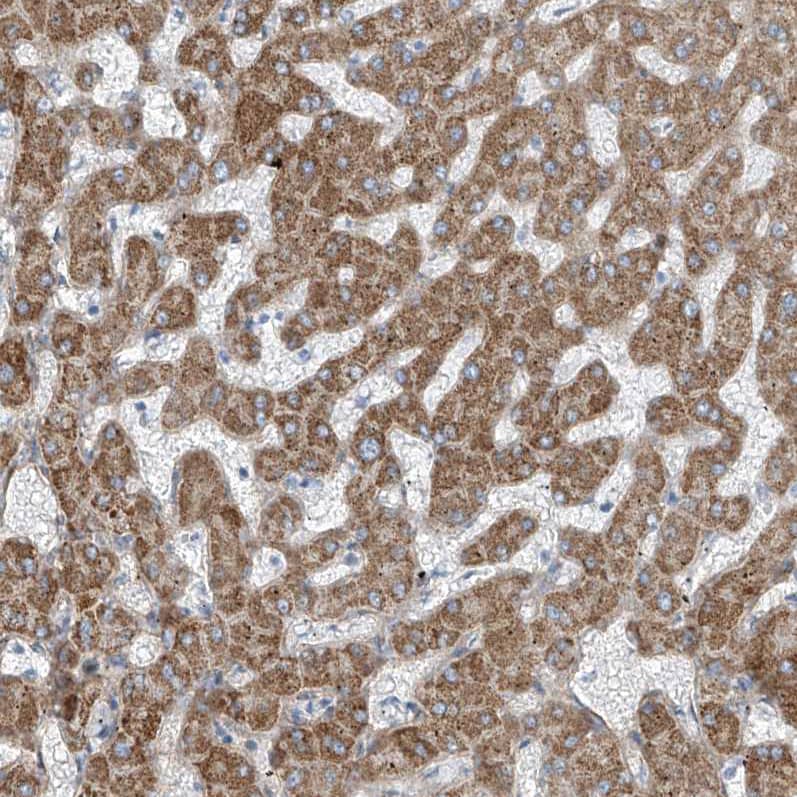 Staining of human liver shows strong cytoplasmic positivity in hepatocytes.