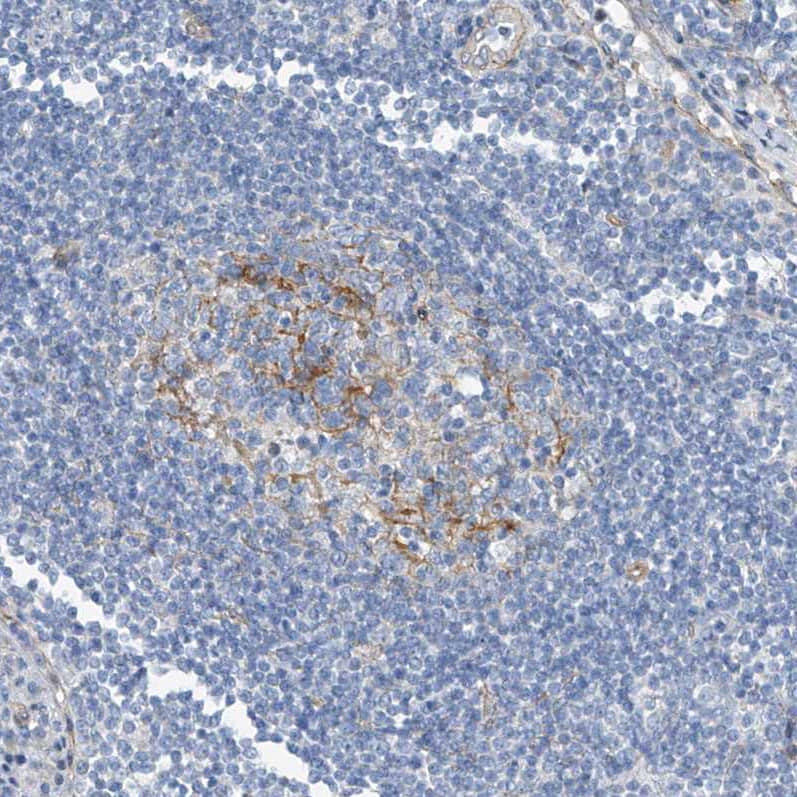 Staining of human lymph node shows moderate membranous positivity in germinal center cells.