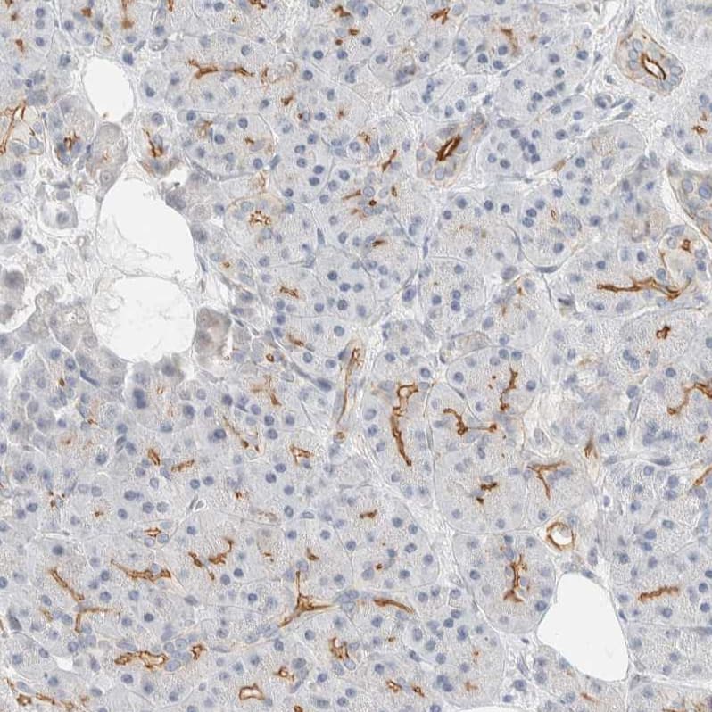 Staining of human Pancreas shows moderate membranous positivity in exocrine glandular cells.