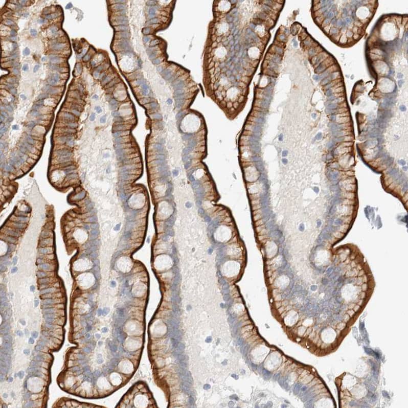 Staining of human Colon shows moderate membranous-cytoplasmic positivity in glandular cells.