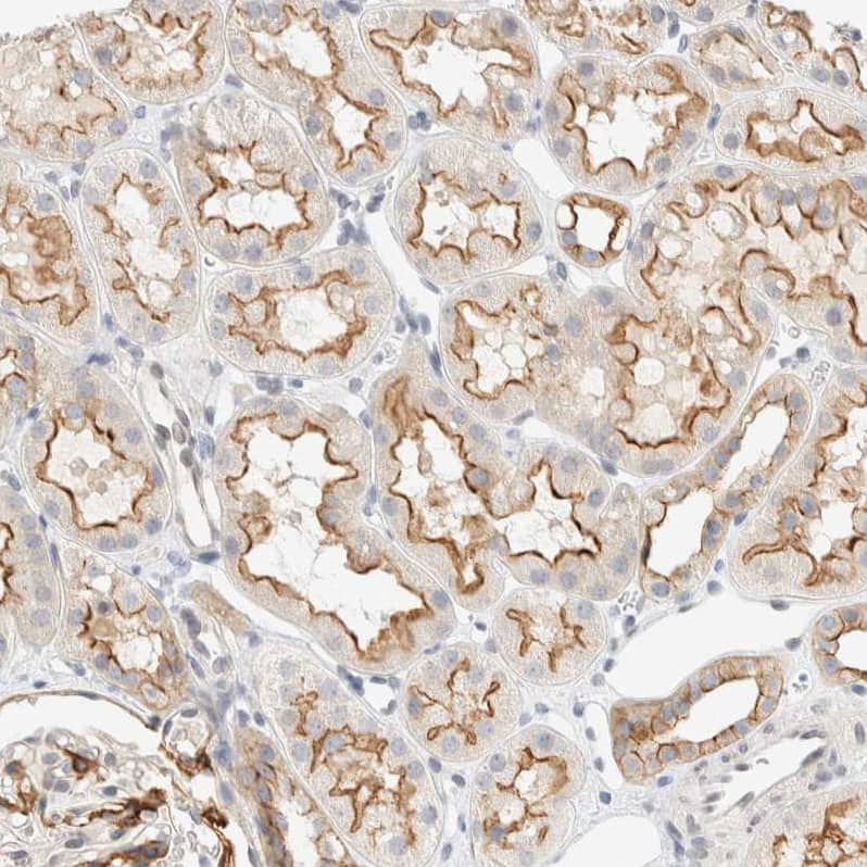 Staining of human Kidney shows moderate membranous and cytoplasmic positivity in cells in tubules.