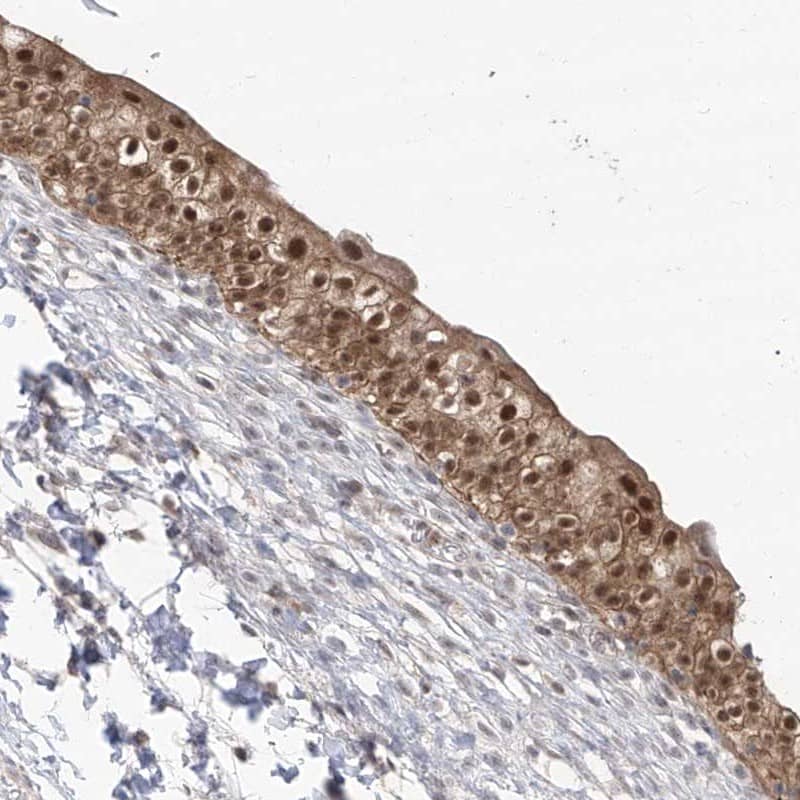 Staining of human urinary bladder shows distinct nuclear and cytoplasmic positivity in urothelial cells.