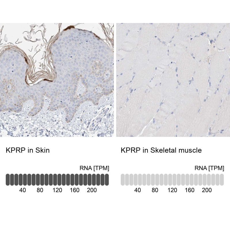 <b>Orthogonal Strategies Validation. </b>Analysis in human skin and skeletal muscle tissues using Anti-KPRP antibody. Corresponding KPRP RNA-seq data are presented for the same tissues.