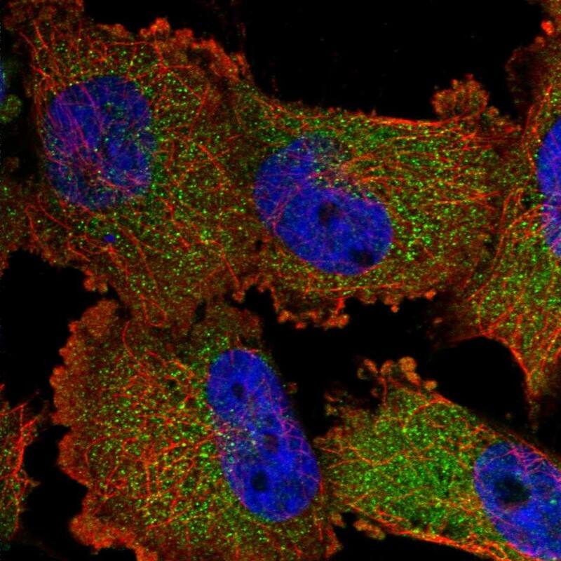 Staining of human cell line U-251 MG shows localization to cytosol.