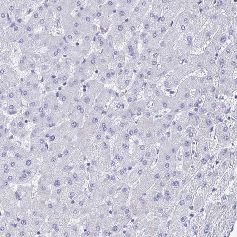 Staining of human liver shows no positivity in hepatocytes as expected.