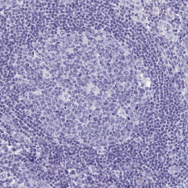 Staining of human lymph node shows no positivity in germinal center cells as expected.