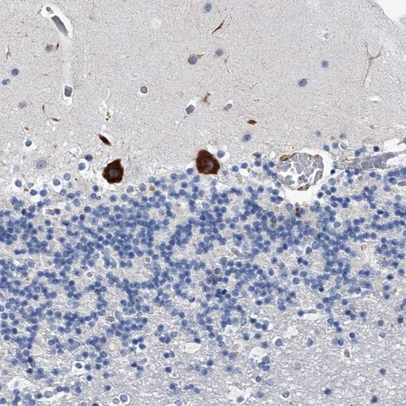 Immunohistochemistry TMEM63C Antibody - BSA Free