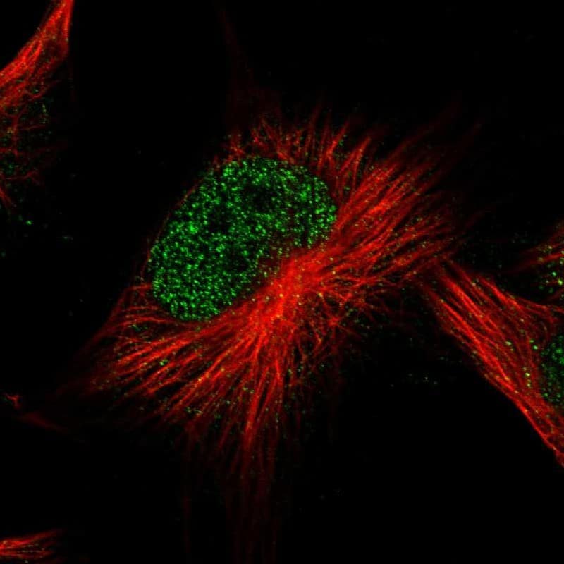 Immunocytochemistry/ Immunofluorescence ATG2B Antibody - BSA Free