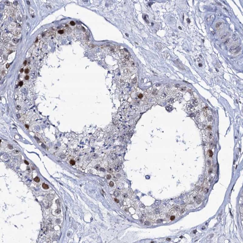 Immunohistochemistry-Paraffin MCMBP Antibody - BSA Free