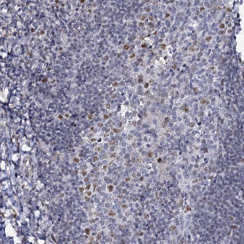 Immunohistochemistry-Paraffin MCMBP Antibody - BSA Free