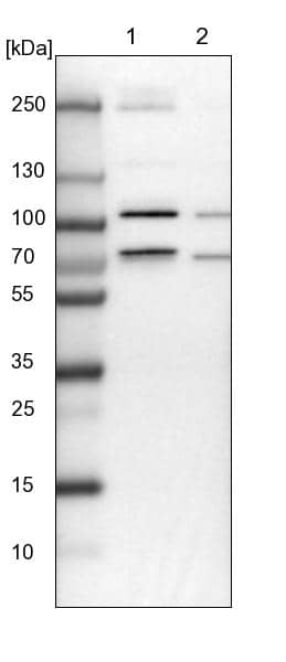 Lane 1: NIH-3T3 cell lysate (Mouse embryonic fibroblast cells)Lane 2: NBT-II cell lysate (Rat Wistar bladder tumour cells)