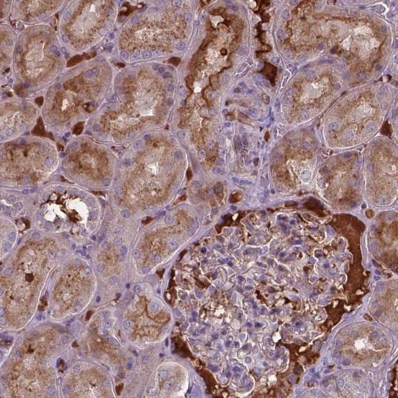 Staining of human kidney shows moderate cytoplasmic positivity in cells in tubules along with distinctly stained extracellular material.