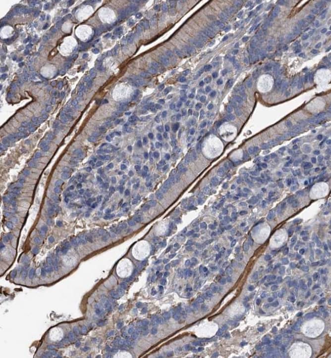 Immunohistochemistry-Paraffin IFITM5 Antibody - BSA Free