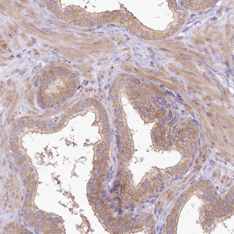 Staining of human prostate shows moderate cytoplasmic/membranous positivity in glandular cells and smooth muscle cells.